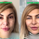 The new trend taking over and dividing users on TikTok is the eye tattoo – How Keratochromatosis Is Done